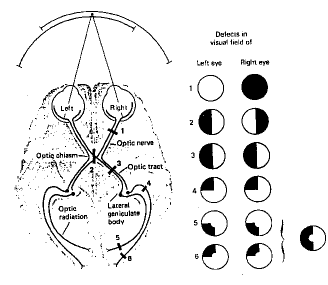 Vibert fig 5